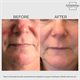 ERC Defence 5pc Skincare Collection - Day & Night Moisturiser, Serum, Cleanser & Wrinkle Reducer - 968232